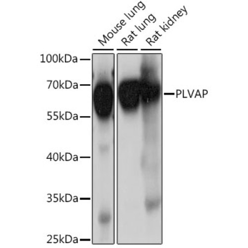 PLVAP Rabbit pAb