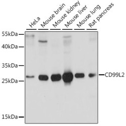 CD99L2 Rabbit pAb
