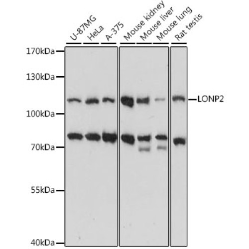 LONP2 Rabbit pAb