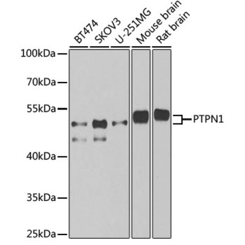 PTPN1 Rabbit pAb