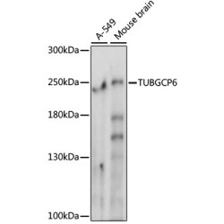 TUBGCP6 Rabbit pAb