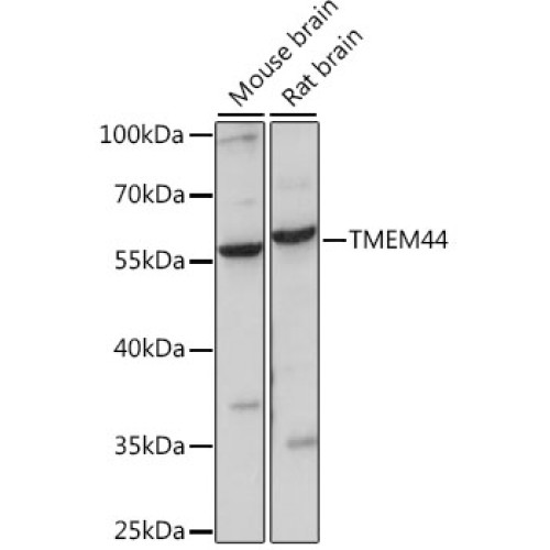 TMEM44 Rabbit pAb