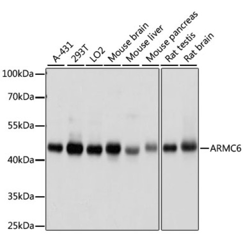 ARMC6 Rabbit pAb
