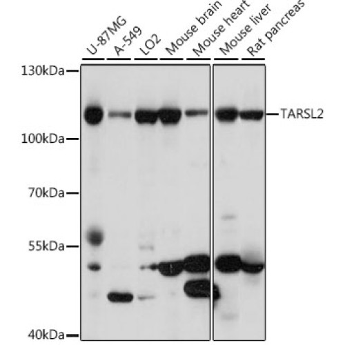TARSL2 Rabbit pAb