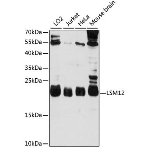 LSM12 Rabbit pAb