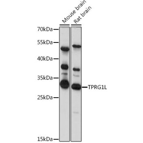 TPRG1L Rabbit pAb