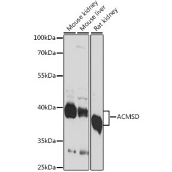 ACMSD Rabbit pAb