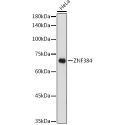 ZNF384 Rabbit pAb