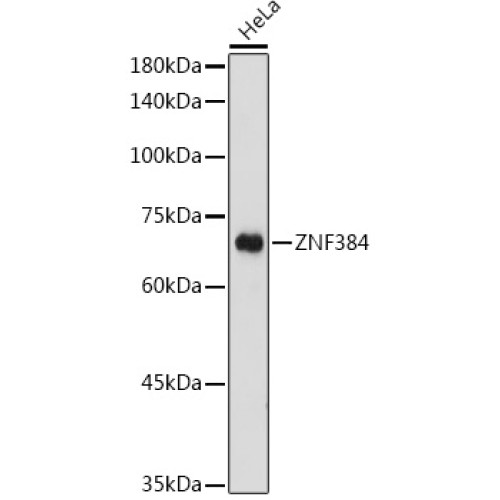 ZNF384 Rabbit pAb
