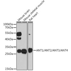 ANT1/ANT2/ANT3/ANT4 Rabbit pAb