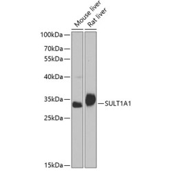 SULT1A1 Rabbit pAb