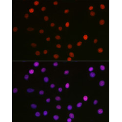 Acetyl-HMGB1-K29 Rabbit pAb