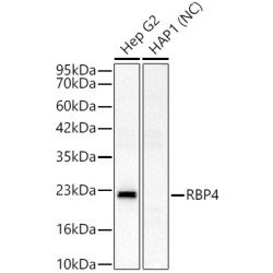RBP4 Rabbit pAb