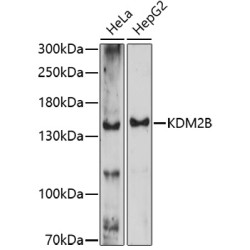 KDM2B Rabbit pAb
