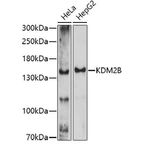 KDM2B Rabbit pAb