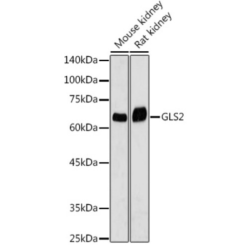 GLS2 Rabbit pAb
