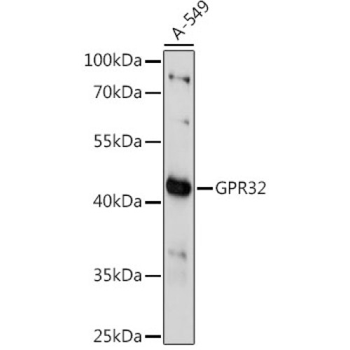 GPR32 Rabbit pAb
