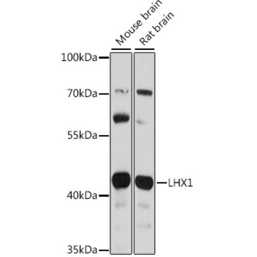 LHX1 Rabbit pAb