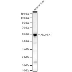 ALDH5A1 Rabbit pAb
