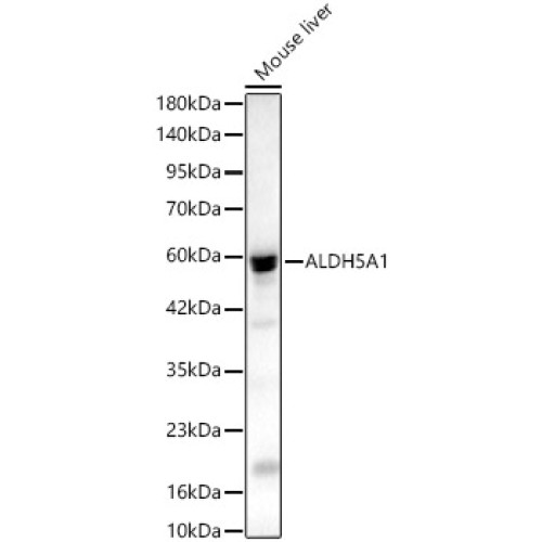 ALDH5A1 Rabbit pAb