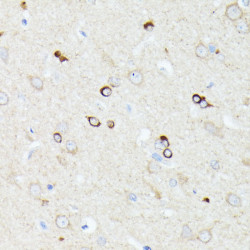 CCDC6 Rabbit pAb