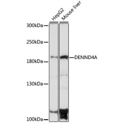 DENND4A Rabbit pAb