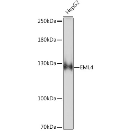 EML4 Rabbit pAb