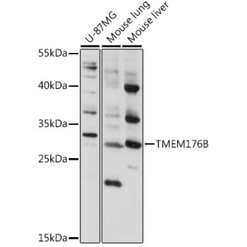 TMEM176B Rabbit pAb