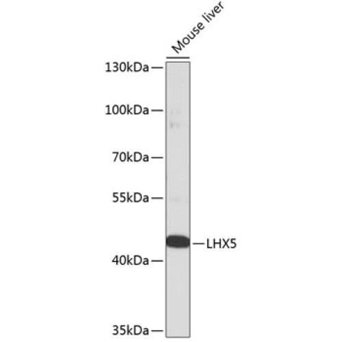 LHX5 Rabbit pAb