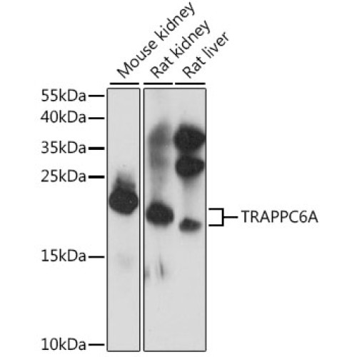 TRAPPC6A Rabbit pAb