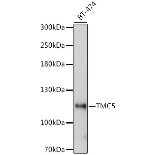 TMC5 Rabbit pAb
