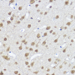 MYOCD Rabbit pAb