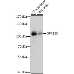 GPR155 Rabbit pAb