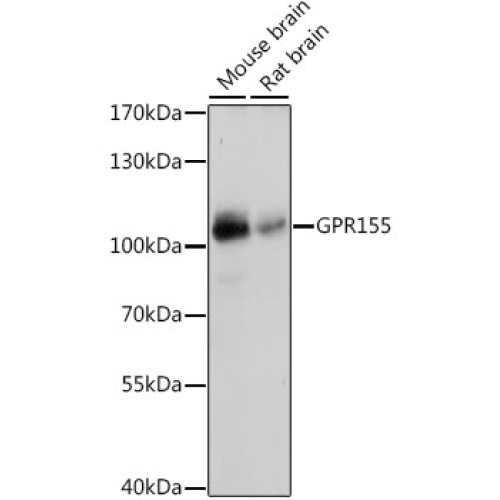 GPR155 Rabbit pAb