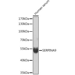SERPINA9 Rabbit pAb