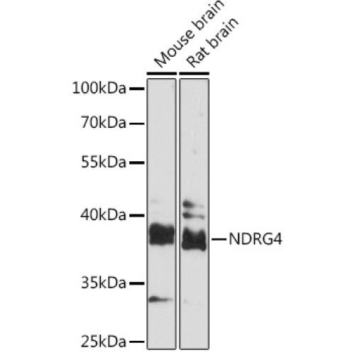 NDRG4 Rabbit pAb