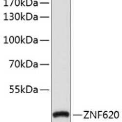 ZNF620 Rabbit pAb