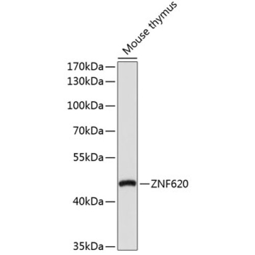 ZNF620 Rabbit pAb