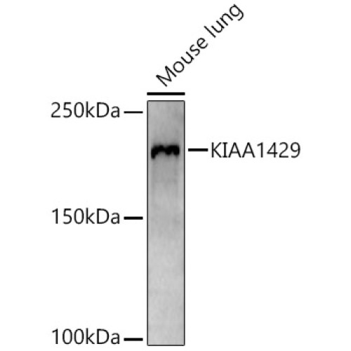 VIRMA/KIAA1429 Rabbit pAb