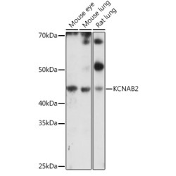 KCNAB2 Rabbit pAb
