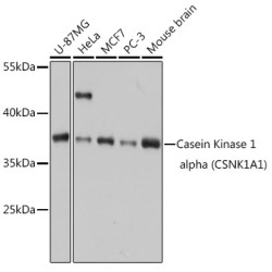 Casein Kinase 1 alpha (CSNK1A1) Rabbit pAb