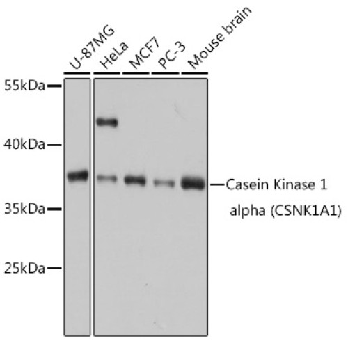 Casein Kinase 1 alpha (CSNK1A1) Rabbit pAb