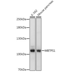MBTPS1 Rabbit pAb