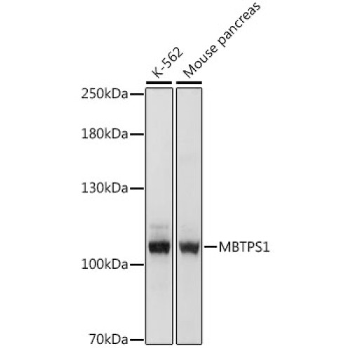 MBTPS1 Rabbit pAb