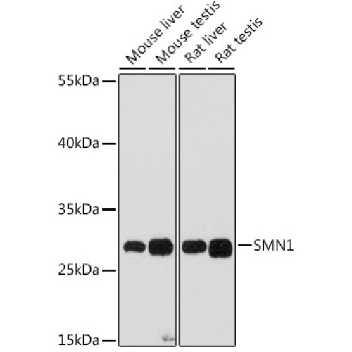 SMN1 Rabbit pAb