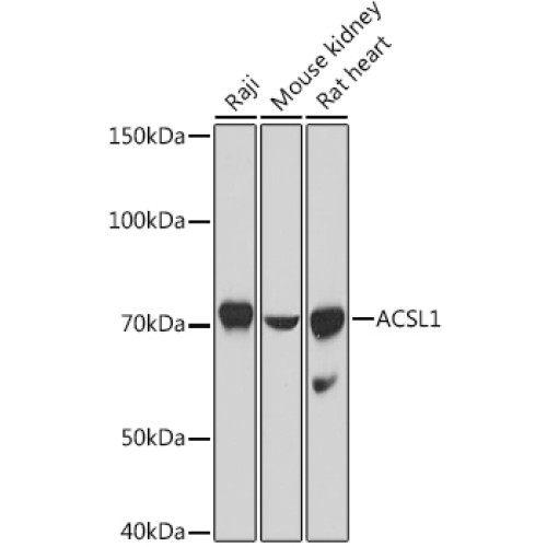 ACSL1 Rabbit pAb
