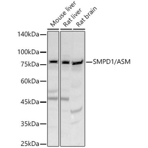 SMPD1 / ASM Rabbit pAb
