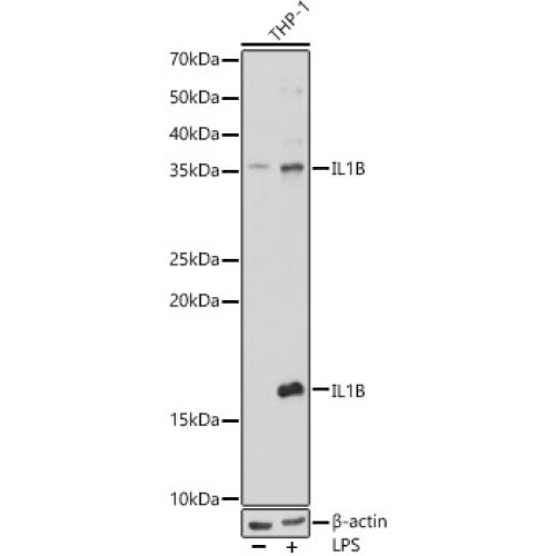 IL1β Rabbit pAb