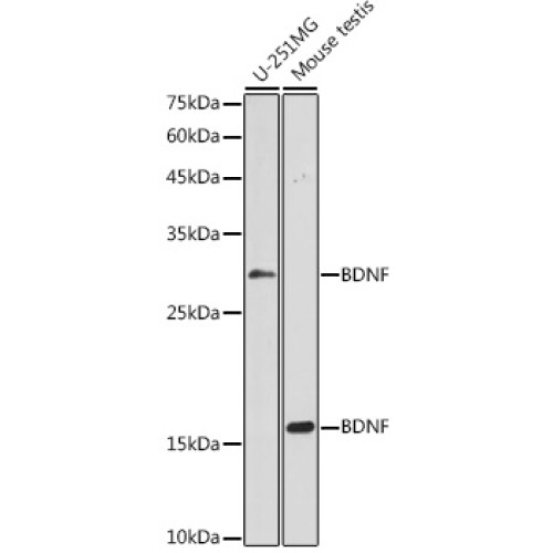 BDNF Rabbit pAb