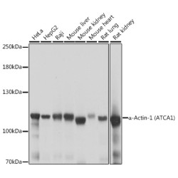α-Actinin-4 Rabbit pAb